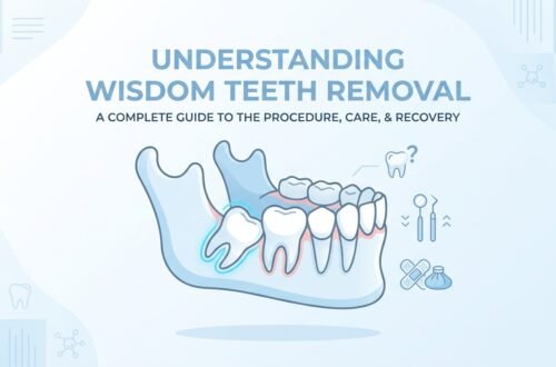 Wisdom Teeth Removal: When You Need It