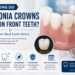 How Long Zirconia Crowns Last on Front Teeth?