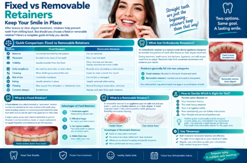 fixed vs removable retainers