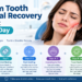 Wisdom Tooth Removal Recovery Timeline